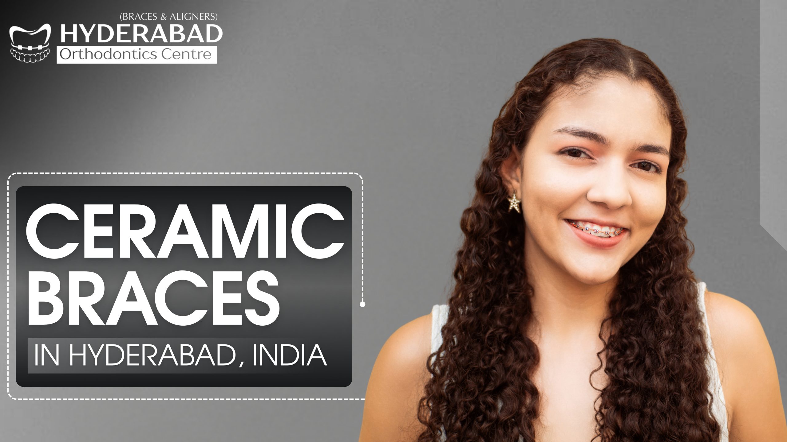 Ceramic Braces in Hyderabad, India – A Complete Guide by Hyderabad Orthodontics Centre