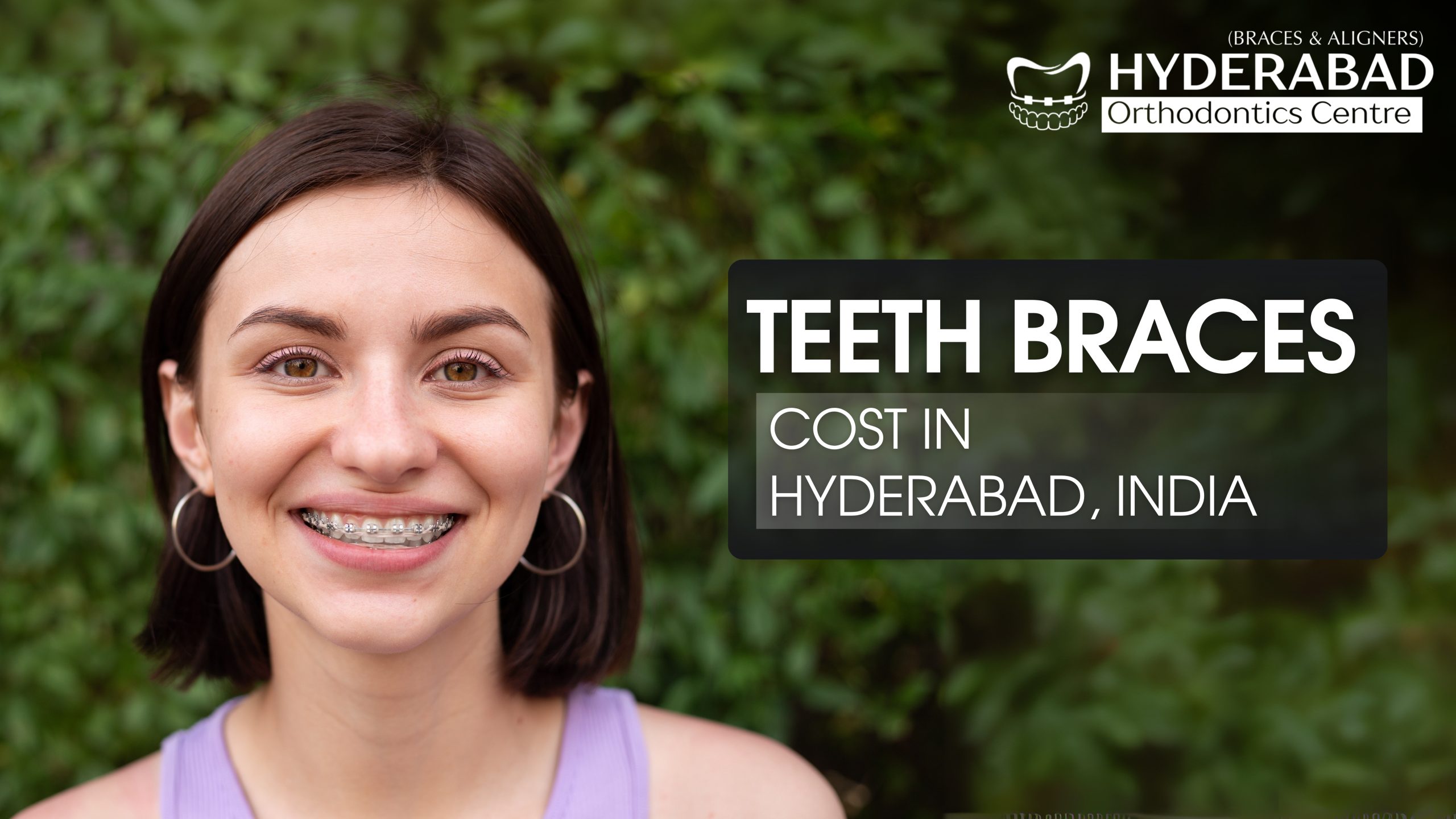 Teeth Braces Cost in Hyderabad