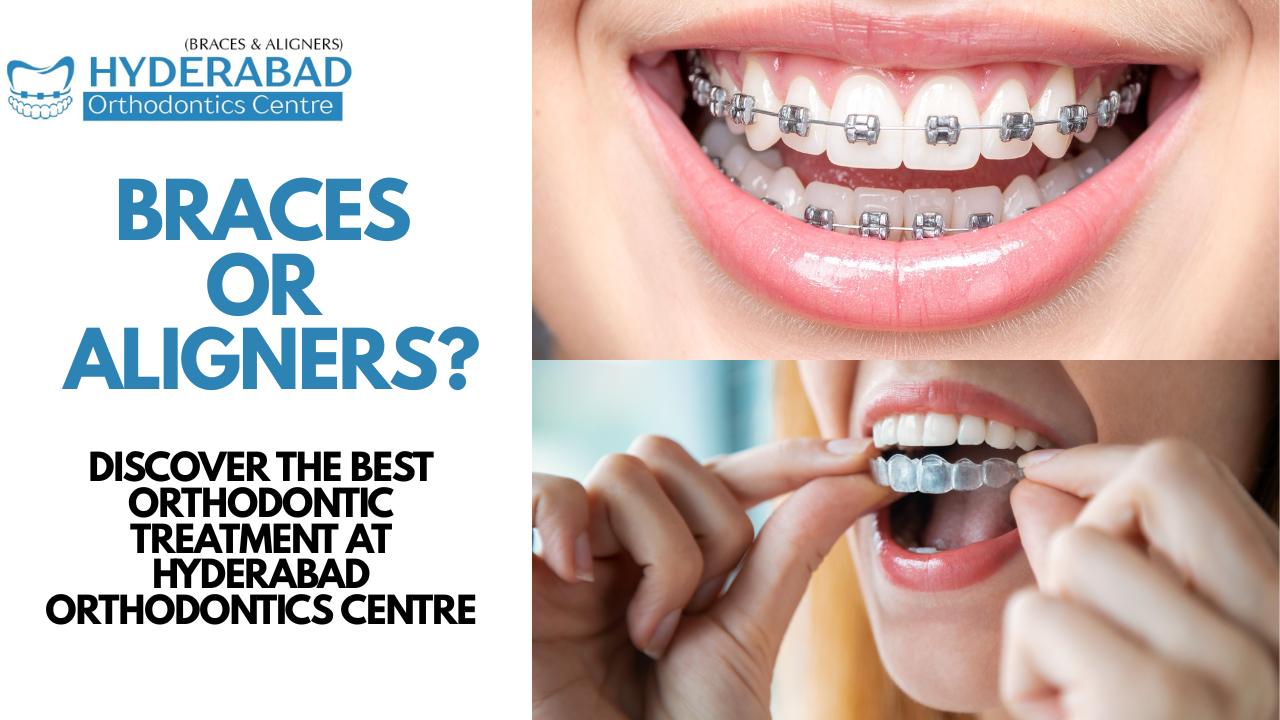 Why Hyderabad Orthodontics Centre is the Best Choice for Braces and Invisible Aligners